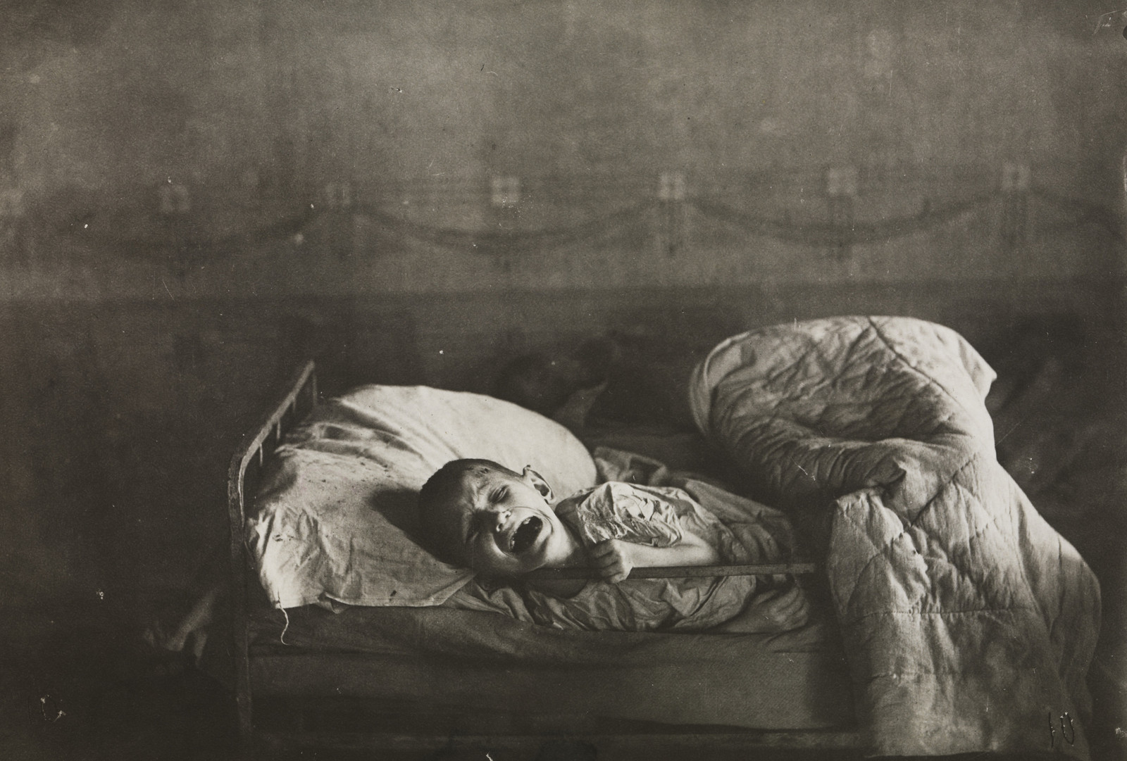 Fra et sykehus for sultende barn i Buguruslan i Orenburg oblast i Russland under hungersnøden
i 1921. En gutt gråter av smerter på grunn av skjørbuk.